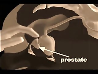 Prostate Massage Techniques